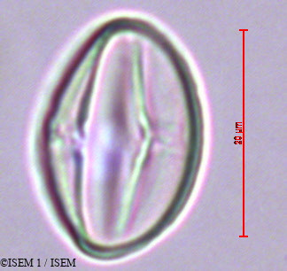 ISEM 1/Umbilicus_rupestris_29385/Umbilicus_rupestris_29385_0005(copy).jpg